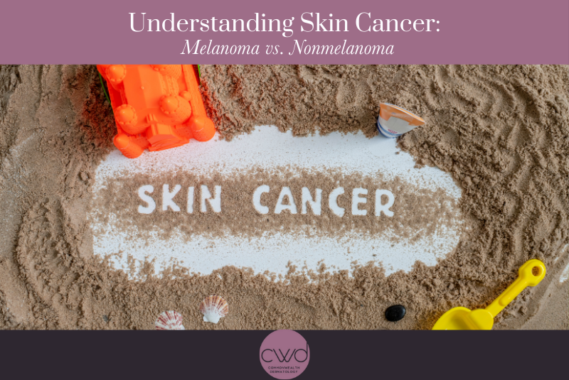 Understanding Skin Cancer: Melanoma vs. Nonmelanoma